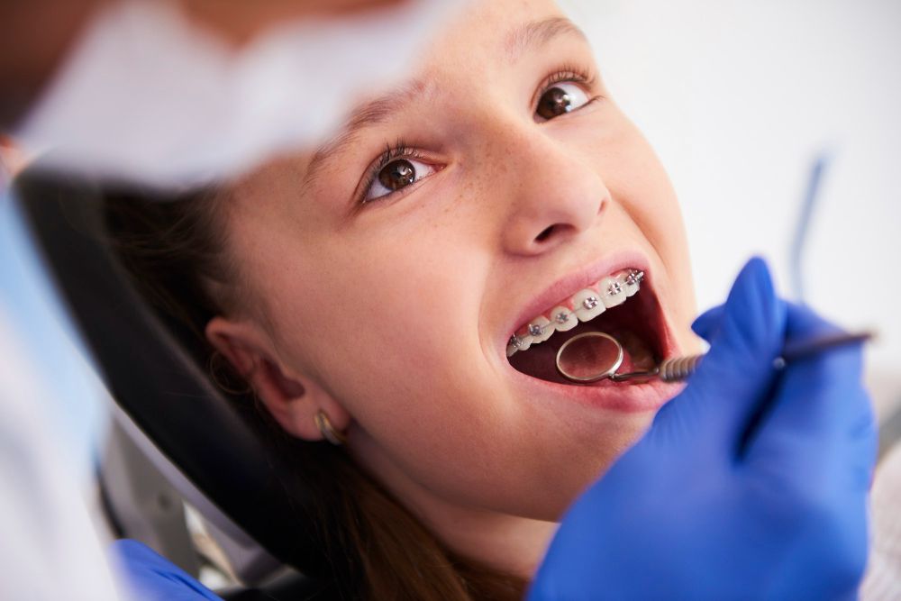 BroadOak MD Dental Services: Fast Braces